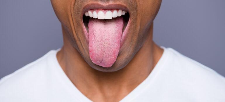 enfermedades de la lengua