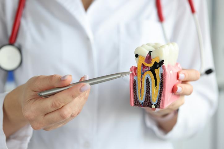 por qué algunas personas tienen más caries